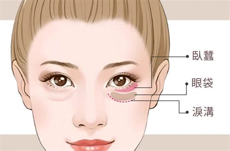 眼袋臥蠶面相|臥蠶、淚溝、眼袋、黑眼圈怎麼分？一篇讓你看懂如何有效消除眼。